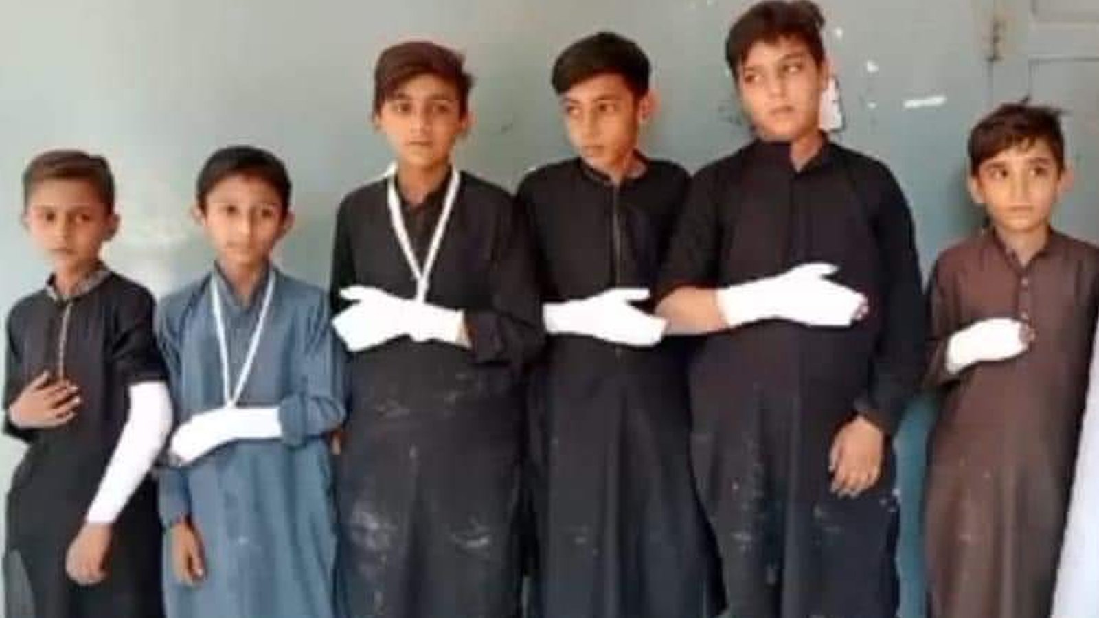 سرکاری سکول میں استاد کا بچوں پر تشدد، 6 بچوں کے بازو توڑ ڈالے