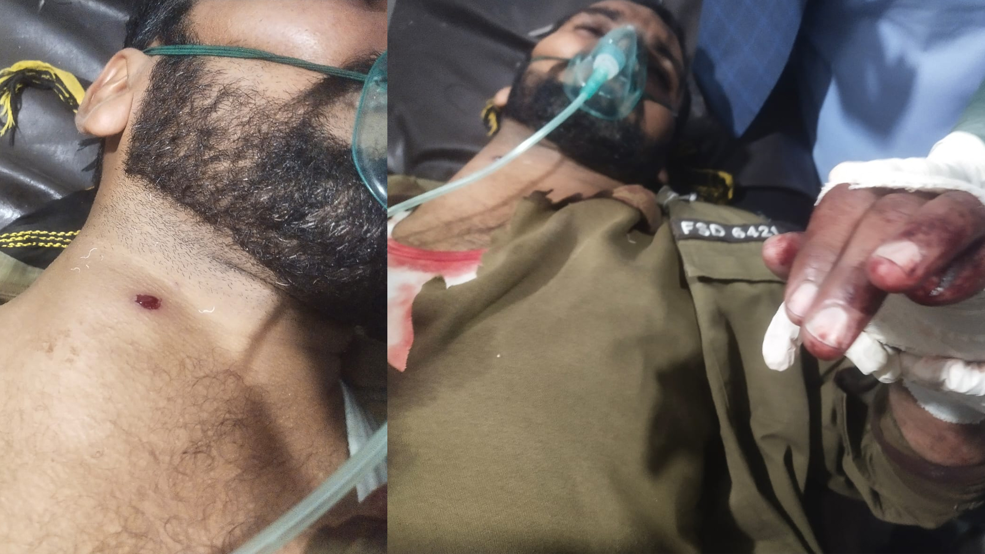 اٹک پولیس کے دو اہلکار گولیاں لگنے سے شدید زخمی