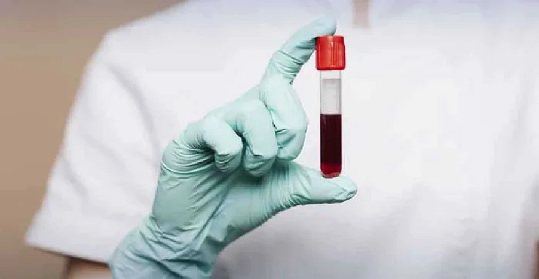 خون کے ایک ٹیسٹ سے 50 سے زائد اقسام کے سرطان کی شناخت ممکن