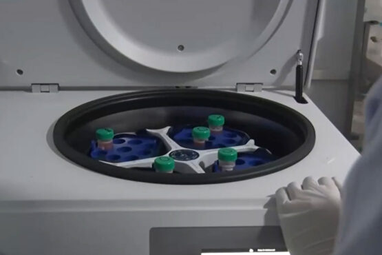 جینڈر سورٹڈ اسٹرا لیپ