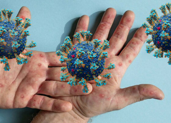 چیچک کا وائرس عالمی وبا پھیلنے کا اندیشہ