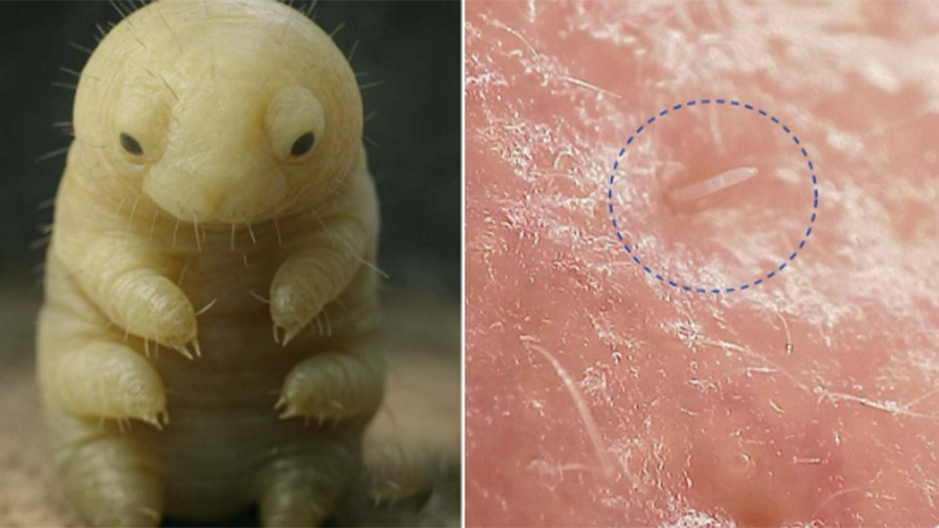 انسانی جلد پر موجود ننھے جاندار، حیران کن حقیقت سامنے آ گئی