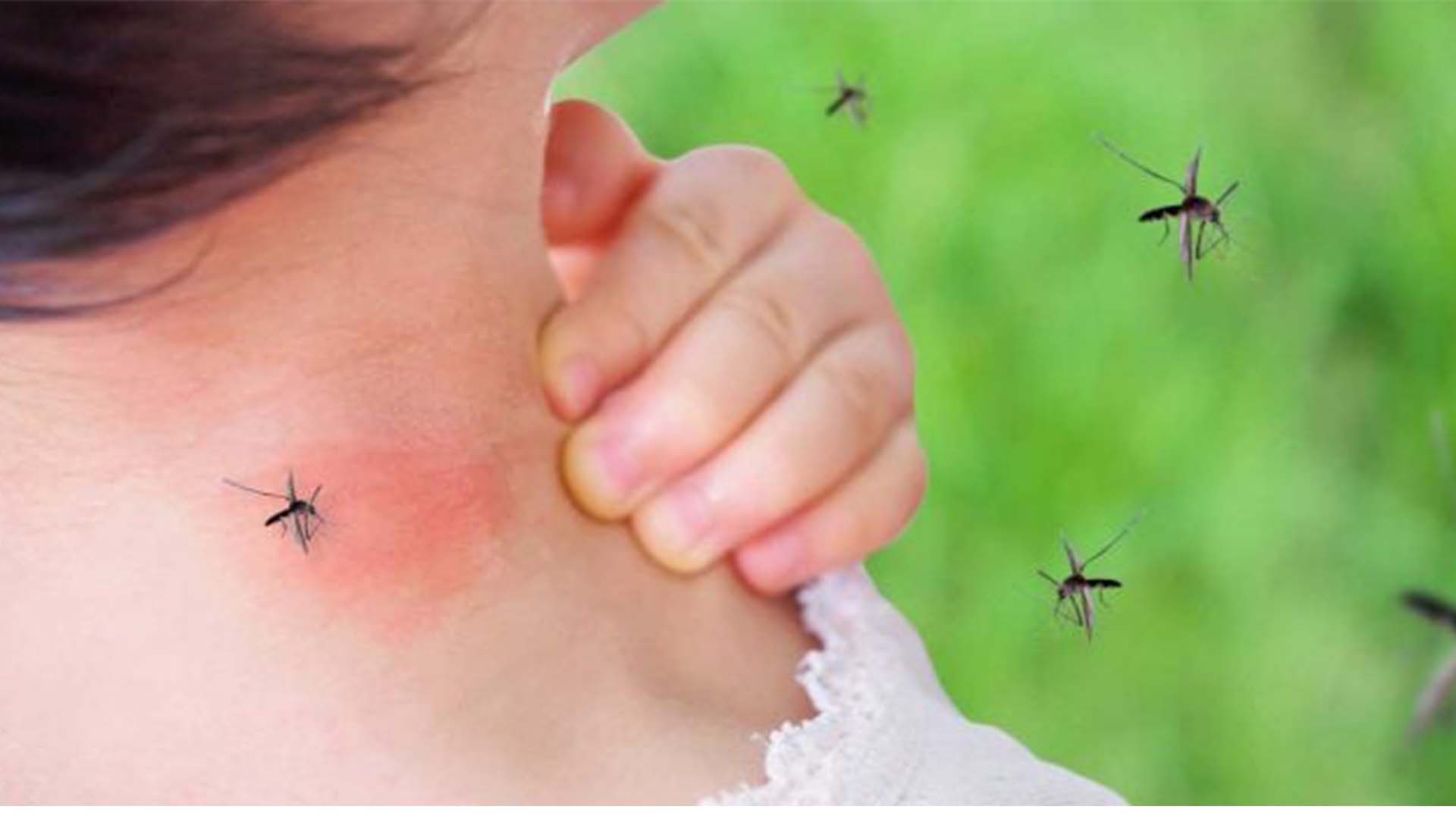 کچھ لوگ مچھروں کا آسان شکار کیوں بنتے ہیں؟ ماہرین نے وجہ بتا دی