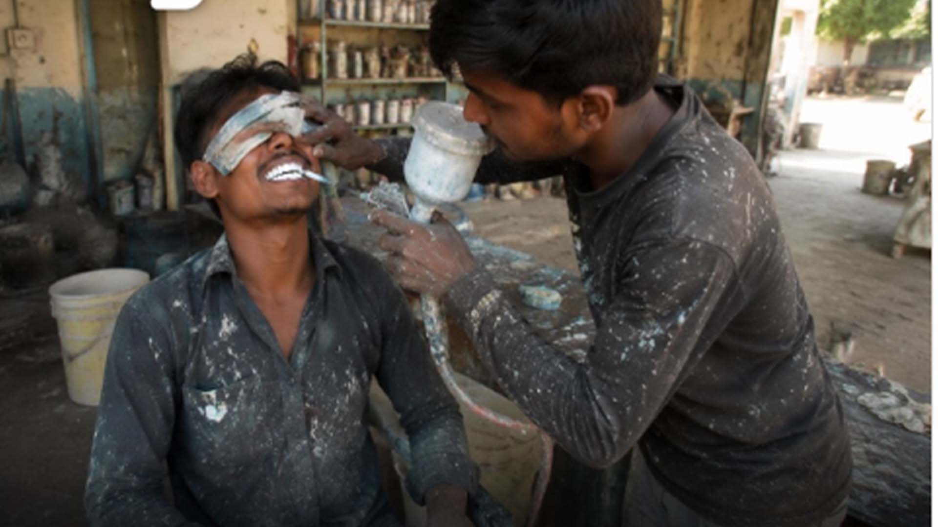 دانت سفید کروانے کے لیے نوجوان نے عجیب طریقہ اپنا لیا