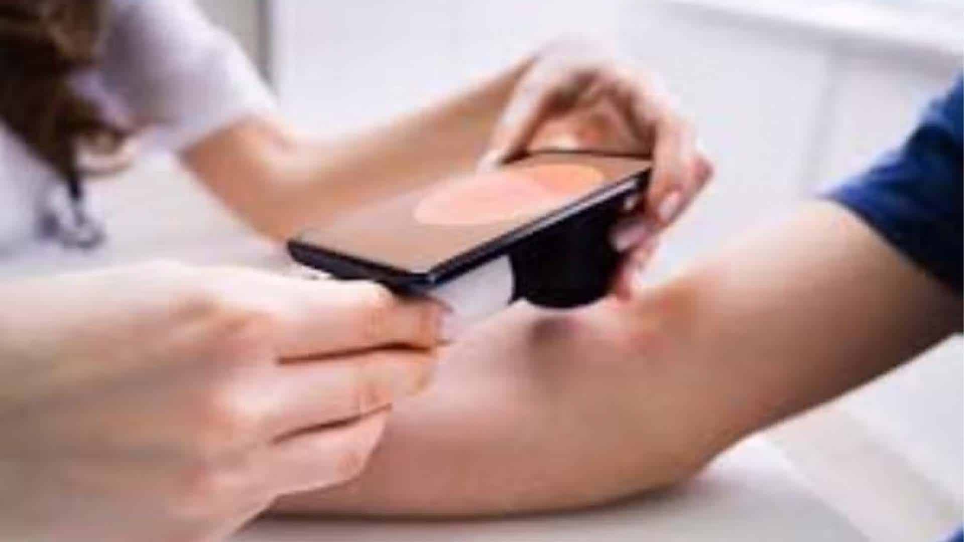 پاکستانی ماہر سرجن کی منفرد کاوش،سکن کینسر کی تشخیص اے آئی چیٹ بوٹ تیار کر لیا