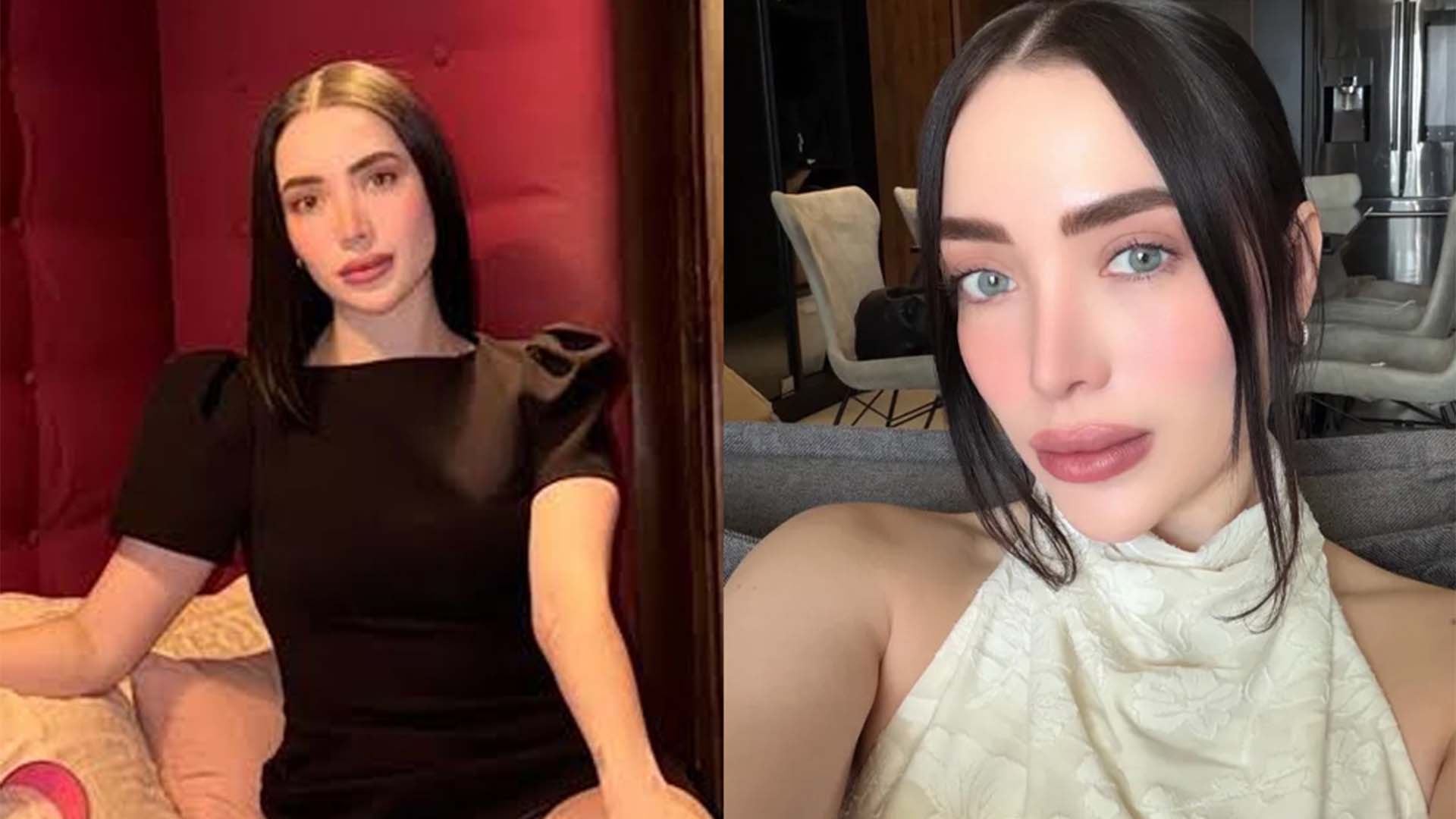 میکسیکو کی معروف سوشل میڈیا اسٹار کاسمیٹک سرجری کے دوران چل بسیں