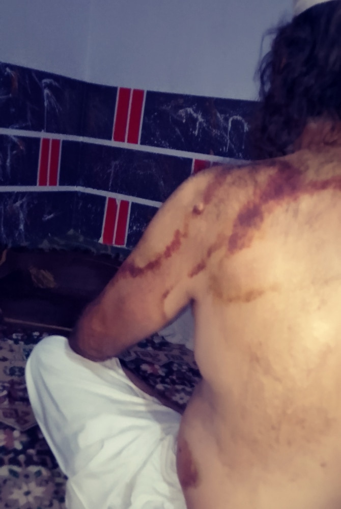 مولوی قدرت اللہ پر تشدد کے بعد کی تصویر