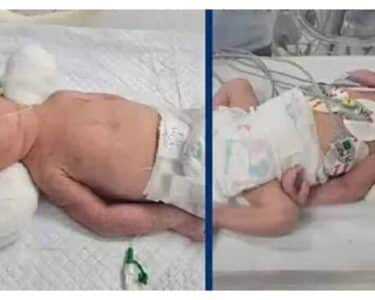 جڑواں بچوں کی پیدائش