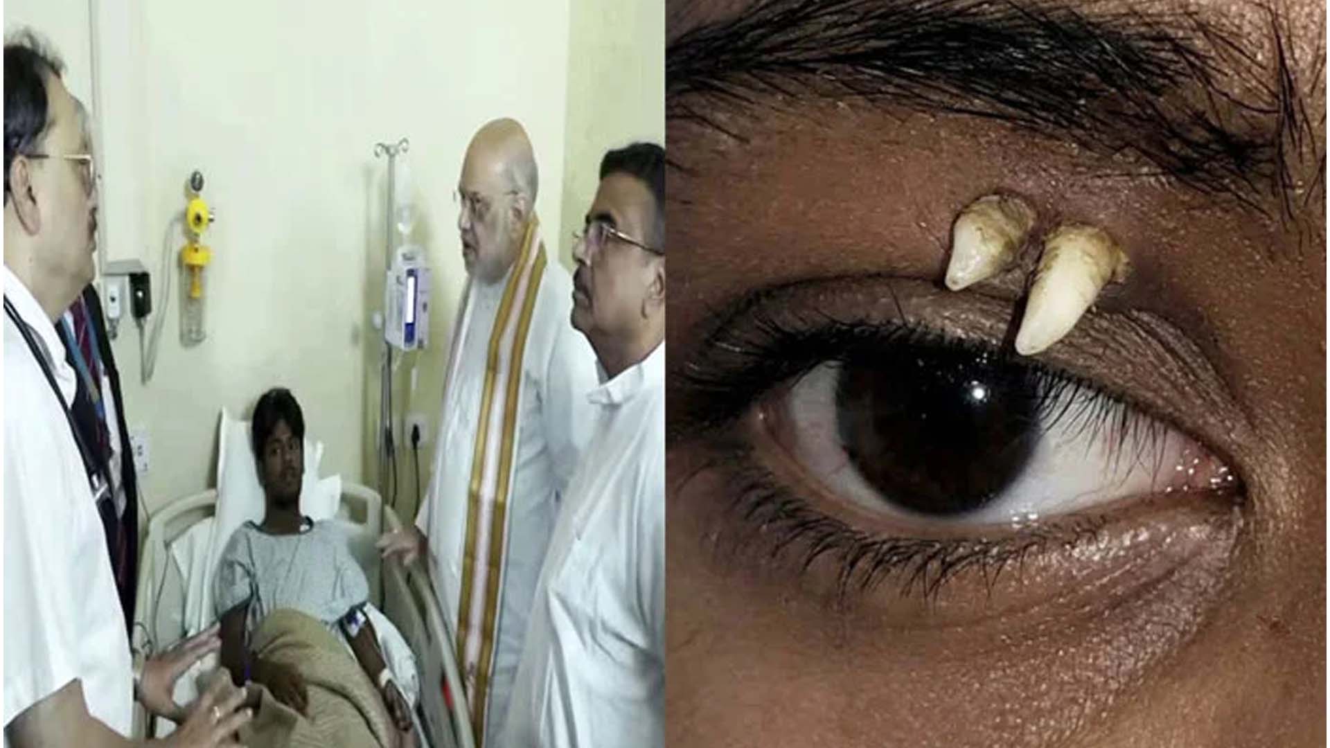 منہ کے بجائے آنکھ کے اوپر نکل آئے دانت، آخر وجہ کیا تھی؟